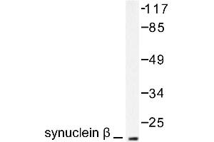 Image no. 1 for anti-Synuclein, beta (SNCB) antibody (ABIN271836) (beta Synuclein anticorps)