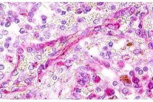 Image no. 1 for anti-Chemokine (C Motif) Receptor 1 (XCR1) (Extracellular Domain) antibody (ABIN1049492)