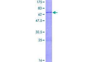 Image no. 1 for Zinc Finger Protein 28 (ZFP28) (AA 1-349) protein (GST tag) (ABIN1325741)