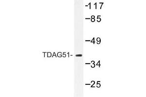 Image no. 1 for anti-Pleckstrin Homology-Like Domain, Family A, Member 1 (PHLDA1) antibody (ABIN317621) (PHLDA1 anticorps)