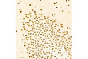 Immunohistochemistry of paraffin embedded rat brain using RB1 (ABIN7075477) at dilution of 1:1400 (400x lens)