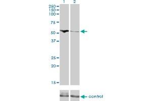 Western blot analysis of CDADC1 over-expressed 293 cell line, cotransfected with CDADC1 Validated Chimera RNAi (Lane 2) or non-transfected control (Lane 1).