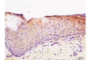 Formalin-fixed and paraffin embedded rat skin tissue labeled with Anti-Integrin beta 1/CD29 Polyclonal Antibody , Unconjugated at 1:200, followed by conjugation to the secondary antibody and DAB staining