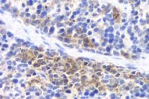 Immunohistochemistry analysis of paraffin-embedded mouse inflammatory spleen using IL-17 (ABIN7074342) at dilution of 1:800 (IL-17 anticorps)