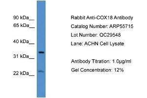 WB Suggested Anti-COX18  Antibody Titration: 0. (COX18 anticorps  (Middle Region))