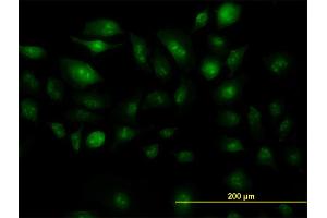 Immunofluorescence of monoclonal antibody to ZIC4 on HeLa cell. (ZIC4 anticorps  (AA 249-319))