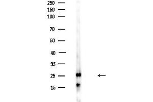 anti-Triosephosphate Isomerase 1 (TPI1) (C-Term) antibody