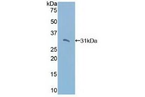Detection of Recombinant TRADD, Human using Polyclonal Antibody to TNFRSF1A Associated Via Death Domain Protein (TRADD) (TRADD anticorps  (AA 61-297))