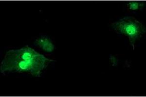 Anti-SDS mouse monoclonal antibody (ABIN2455363) immunofluorescent staining of COS7 cells transiently transfected by pCMV6-ENTRY SDS (RC217814). (serine Dehydratase anticorps)