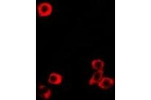 Immunofluorescent analysis of RBP2 staining in MCF7 cells. (RBP2 anticorps)