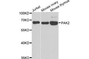 Western blot analysis of extracts of various cell lines, using PAK2 antibody. (PAK2 anticorps)