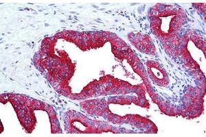 Human Prostate: Formalin-Fixed, Paraffin-Embedded (FFPE) (LAMP2 anticorps)