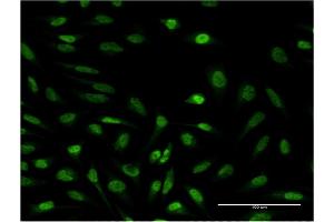 Immunofluorescence of monoclonal antibody to SUPT4H1 on HeLa cell.