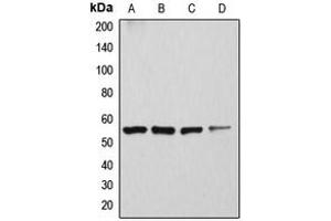 Western blot analysis of ATP6V1H expression in Caki1 (A), SKNSH (B), rat kidney (C), mouse brain (D) whole cell lysates. (ATP6V1H anticorps  (Center))