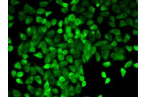 Immunofluorescence analysis of A549 cell using CASP3 antibody. (Caspase 3 anticorps  (AA 55-160))