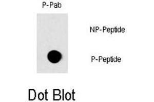 Dot blot analysis of RAF1 (phospho S296) polyclonal antibody  on nitrocellulose membrane.