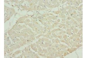 Immunohistochemistry of paraffin-embedded human heart tissue using ABIN7147524 at dilution of 1:100 (CHMP4B anticorps  (AA 1-224))