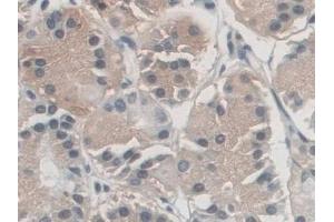 Detection of AZIN1 in Human Stomach Tissue using Polyclonal Antibody to Antizyme Inhibitor 1 (AZIN1) (Antizyme Inhibitor 1 anticorps  (AA 5-290))