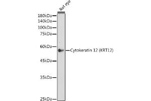 Western blot analysis of extracts of Rat eye, using Cytokeratin 12 (KRT12) (KRT12) antibody (ABIN7268087) at 1:500 dilution. (KRT12 anticorps)
