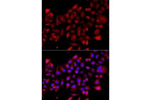 Immunofluorescence analysis of A549 cells using RRM2B antibody (ABIN5974964). (RRM2B anticorps)