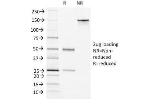 SDS-PAGE Analysis Purified vWF Mouse Monoclonal Antibody (VWF/1465).