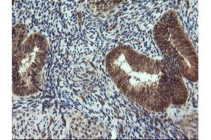 Image no. 3 for anti-Tripartite Motif Containing 44 (TRIM44) antibody (ABIN1501505) (TRIM44 anticorps)