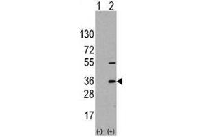 Image no. 1 for anti-Signal Sequence Receptor, alpha (SSR1) (N-Term) antibody (ABIN356936) (SSR1 anticorps  (N-Term))