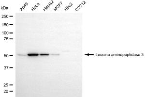 Western blotting analysis using leucine aminopeptidase 3 antibody (ABIN7798268).