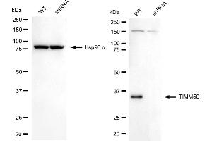 Western blotting analysis using TIMM50 antibody (ABIN7800616).