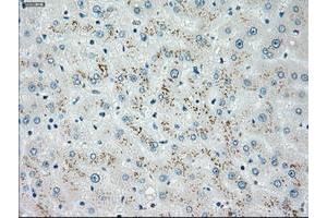 Image no. 4 for anti-Checkpoint Kinase 2 (CHEK2) antibody (ABIN1497495)