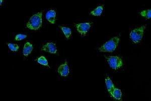 IF analysis of CPS1 using anti-CPS1 antibody (ABIN7599871). (CPS1 anticorps  (AA 124-379))