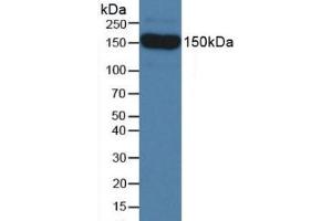 Figure. (SEMA5B anticorps  (AA 836-1013))