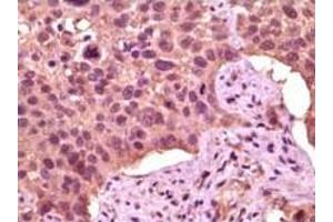 Immunohistochemistry (IHC) image for anti-Glycogen Synthase Kinase 3 alpha (GSK3a) (truncated) antibody (ABIN2464059)