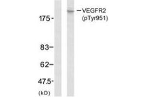 Western blot analysis of extracts from SK-OV3 cells, using VEGFR2 (Phospho-Tyr951) Antibody. (VEGFR2/CD309 anticorps  (pTyr951))