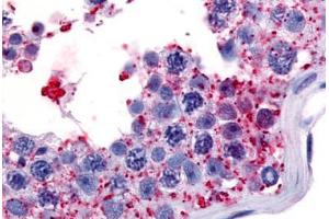 Human Testis (formalin-fixed, paraffin-embedded) stained with WNK1 antibody ABIN213556 at 7 ug/ml followed by biotinylated goat anti-rabbit IgG secondary antibody ABIN481713, alkaline phosphatase-streptavidin and chromogen. (WNK1 anticorps  (Internal Region))