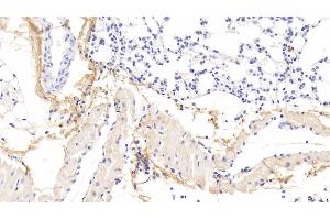 Detection of OGN in Mouse Lung Tissue using Polyclonal Antibody to Osteoglycin (OGN) (OGN anticorps  (AA 180-298))