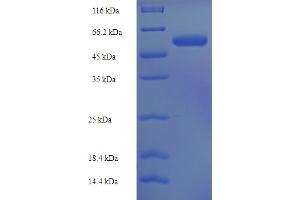 SDS-PAGE (SDS) image for ST3 beta-Galactoside alpha-2,3-Sialyltransferase 3 (ST3GAL3) (AA 29-375) protein (His-SUMO Tag) (ABIN5711243)
