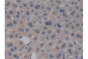 Detection of GSTt1 in Mouse Liver Tissue using Polyclonal Antibody to Glutathione S Transferase Theta 1 (GSTt1)