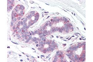 Anti-SLC39A6 antibody IHC of human breast. (SLC39A6 anticorps  (N-Term))