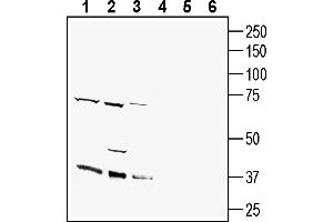 Western blot analysis of rat brain lysates (lanes 1 and 4), mouse brain lysates (lanes 2 and 5) and rat brain stem lysates (lanes 3 and 6):1-3.