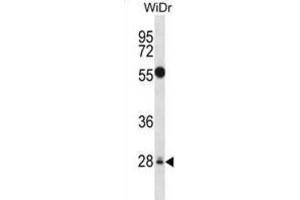 Western Blotting (WB) image for anti-Mediator Complex Subunit 6 (MED6) antibody (ABIN2998132) (MED6 anticorps)