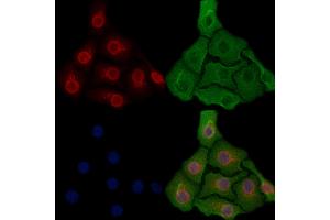 ABIN6256891 and ABIN6274295 staining Hela cells by IF/ICC. (ADK anticorps  (N-Term))