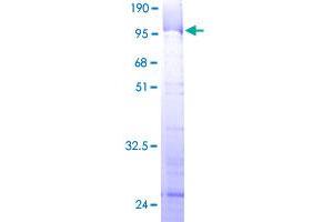 Image no. 1 for Ribosomal RNA Processing 1 Homolog A (RRP1) (AA 1-461) protein (GST tag) (ABIN1318912)
