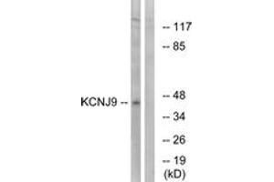 Western blot analysis of extracts from LOVO cells, using KCNJ9 Antibody. (KCNJ9 anticorps  (AA 61-110))