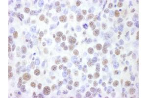 Immunohistochemistry (IHC) image for anti-SWI/SNF Related, Matrix Associated, Actin Dependent Regulator of Chromatin, Subfamily A, Member 4 (SMARCA4) (AA 50-100) antibody (ABIN7454978)
