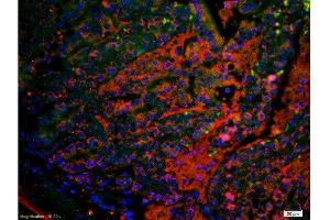 anti-Uroplakin 1B (UPK1B) (AA 150-197) antibody