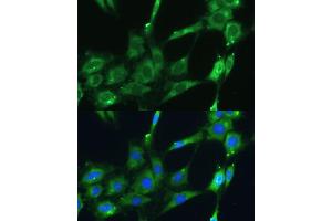 Immunofluorescence analysis of C6 cells using SPARC Polyclonal Antibody (ABIN7270183) at dilution of 1:100 (40x lens).