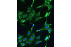 Immunofluorescence analysis of C6 cells using SPARC Polyclonal Antibody (ABIN7270183) at dilution of 1:100 (40x lens).