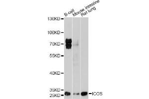 Western blot analysis of extracts of various cell lines, using ICOS antibody (ABIN1873127) at 1:1000 dilution.