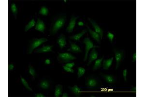 Immunofluorescence of monoclonal antibody to TCF19 on HeLa cell. (TCF19 anticorps  (AA 17-102))